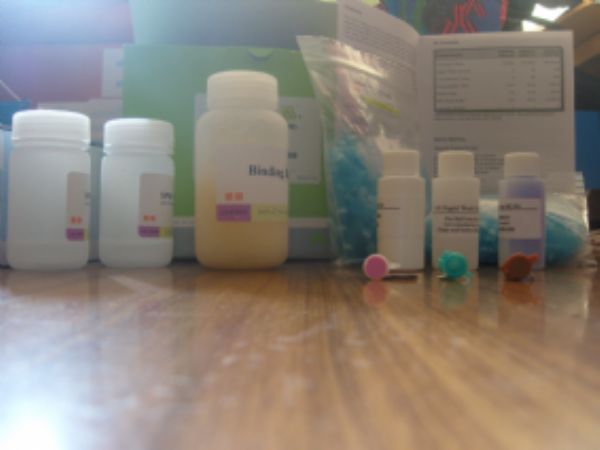 人抗染色体抗体(anti-chromosome Ab)ELISA试剂盒