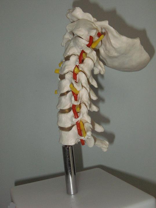 颈椎骨带颈动脉椎间盘与神经模型