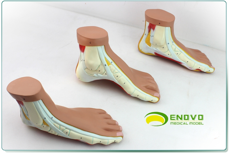 enovo颐诺医学正常足扁平足弓形足高弓足模型脚足弓模型 运动系统