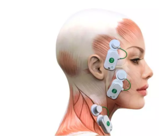 BTS TMJ 無線表肌電系統（口腔版）