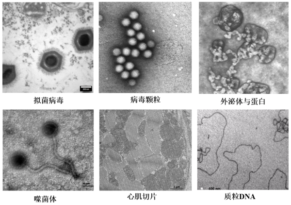 低電壓、無負染，LNP成像新突破——生物型透射電鏡LVEM