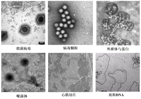 低电压、无负染，LNP成像新突破——生物型透射电镜LVEM