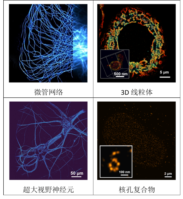 3D單分子超分辨成像系統落戶國內多所知名院校，15nm超高分辨，大視野單分子成像必備！