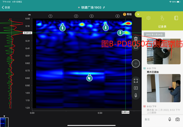 阵列式超声与结构雷达组合的优异表现