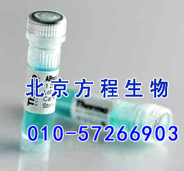 方程生物试剂图片 (4).jpg 人桥粒联结蛋白(AHNAK)检测/(ELISA)kit试剂盒/免费检测