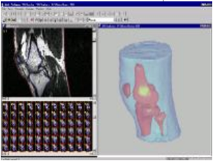 3D-DOCTOR | 三维图像处理软件
